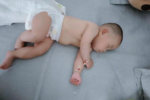 玉林宝宝脸上有白色斑块
